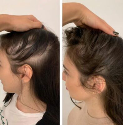 Experts Stunned: A Tiny Organ Holds the Secret to Thick, Healthy Hair at Any Age! 18