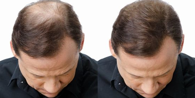 Experts Stunned: A Tiny Organ Holds the Secret to Thick, Healthy Hair at Any Age! 5