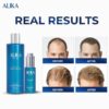 Alika For Men – Serum (3 Pack-60 day) 6